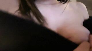 Im Shy but i Give u my Scarred Boobs Ouch :(((((